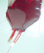 מתן עירוי כדוריות דם אדומות סביב ניתוח בטני אלקטיבי מג'ורי מלווה בסיכון מוגבר לסיבוכים (Br J Anaesth)