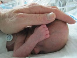 השוואת גמילה מ-CPAP בלבד אל מול גמילה באמצעות קנולה נזאלית מחוממת ולחה בזרם גבוה בפגים (Arch Dis Child Fetal Neonatal Ed) והערות עורך ניאונטולוגיה ד''ר ברזילי