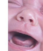 מקרה קצר: הקאות פתאומיות, עלייה בחום הגוף ומרפס בולט אצל תינוק בן 7 חודשים (CME)