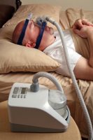 טיפול בלחץ אוויר חיובי עשוי להאט הידרדרות קוגניטיבית במבוגרים עם דום נשימה חסימתי בשינה (Neurology)