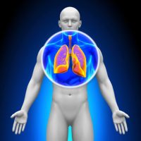 השפעת זיהום אוויר על הופעת סרטן ריאות מוערכת בחסר (WCLC 2022)