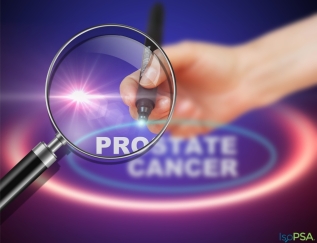 סרטן הערמונית PROSTATE CANCER