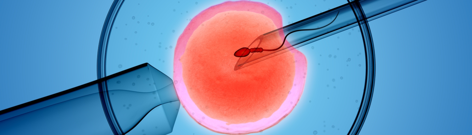 IVF, פוריות, הפריה חוץ גופית