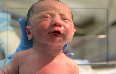 נאונטולוגיה תינוק BABY ילדים ילד NEONATOLOGY PRETERM NEONAT