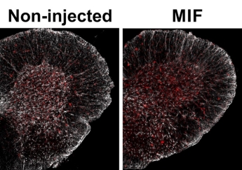 גישה חדשנית למחלת ALS: העלאת רמות החלבון MIF בתאי עצב (Cell Reports Medicine)