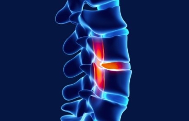 ראומטולוגיה Rheumatologist